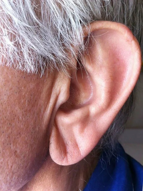 Симптом Франка