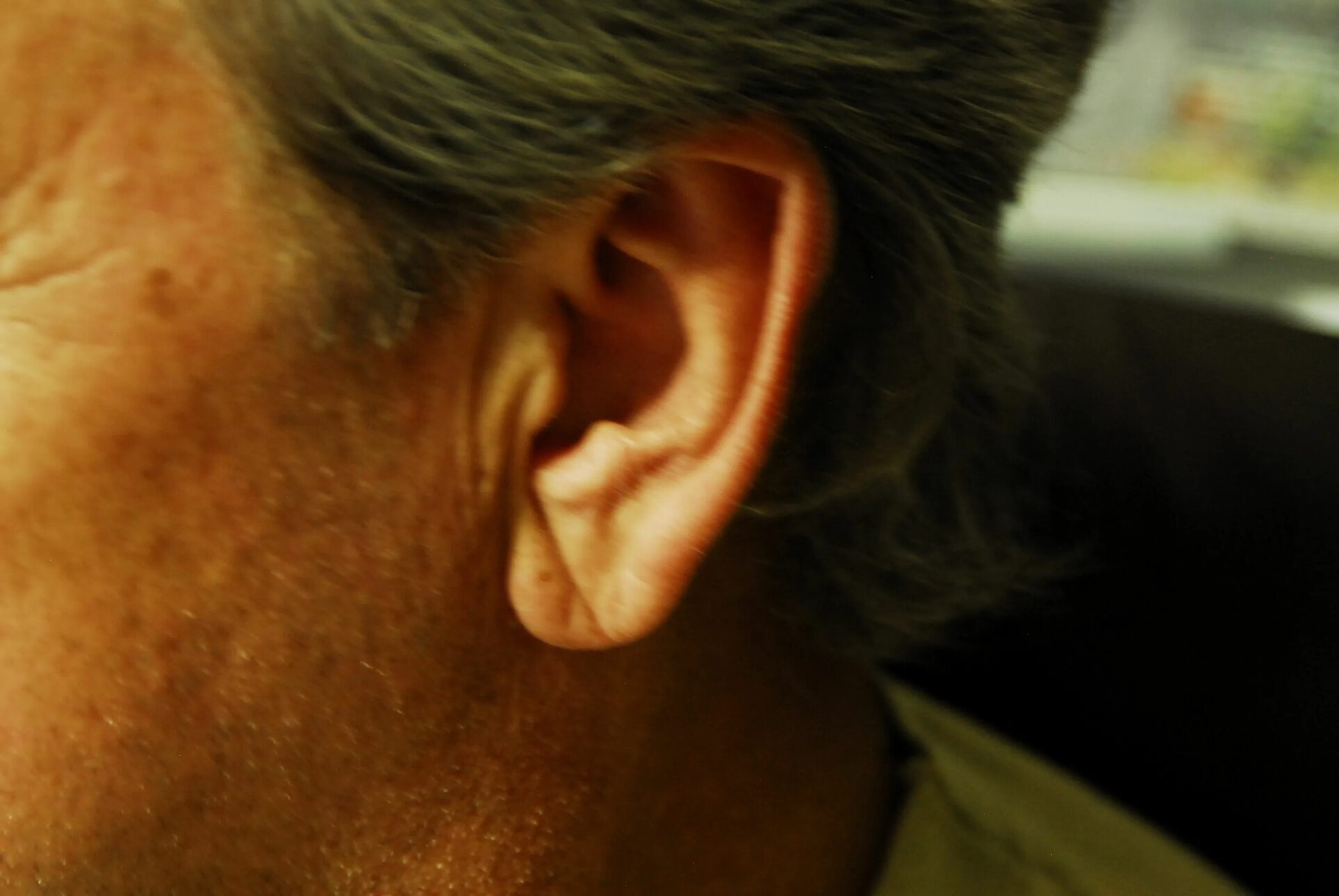 Симптом Франка